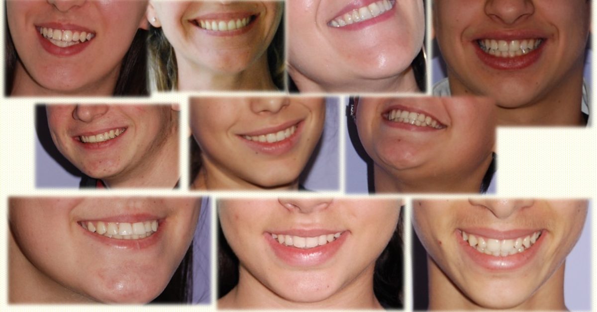 Apparecchi ortodontici